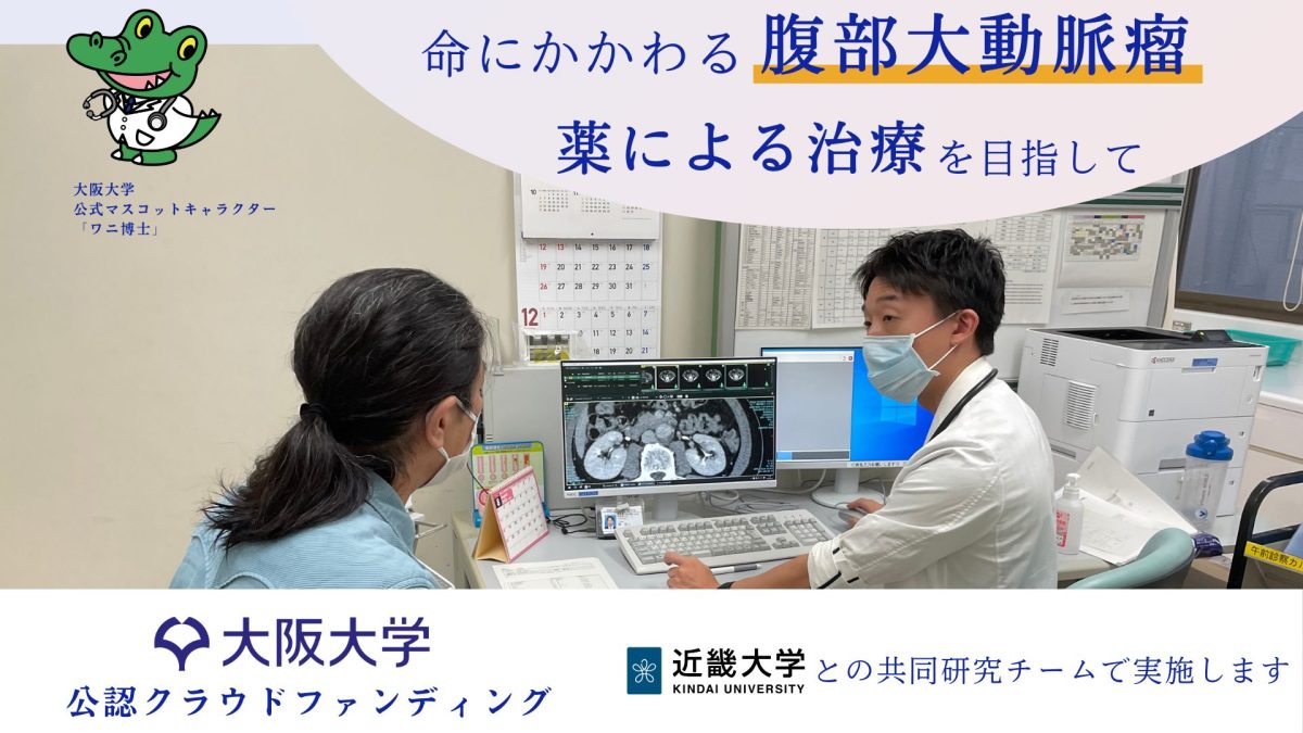 【吹田市】「腹部大動脈瘤」臨床研究から治療法への光を見出したい！クラファンを実施中