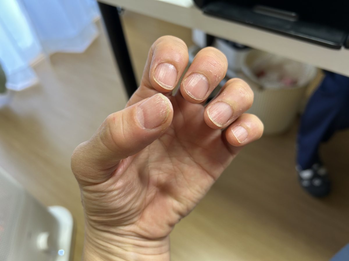 よく見たら（よく見なくても）汚い　縦線がいっぱい　乾燥と老化らしい(涙)